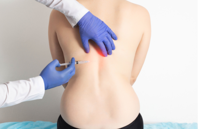 How Many Times Can You Get Trigger Point Injections? - NOVA Interventional  Pain and Spine